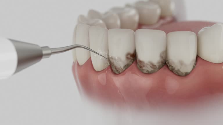 Reliable Emergency Dentist contractor in Rusk, TX by Smile Center Dentistry